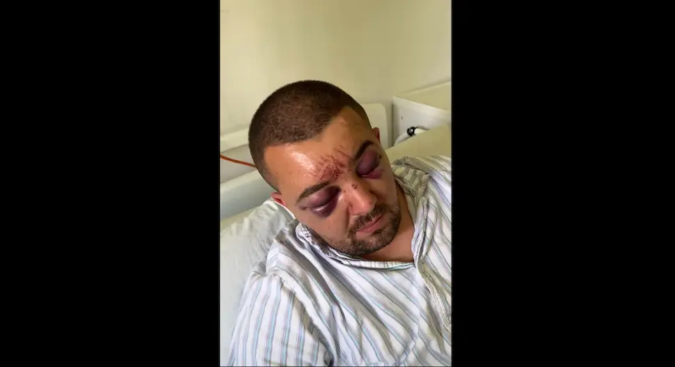 Mladić brutalno pretučen nakon sukoba u kafani